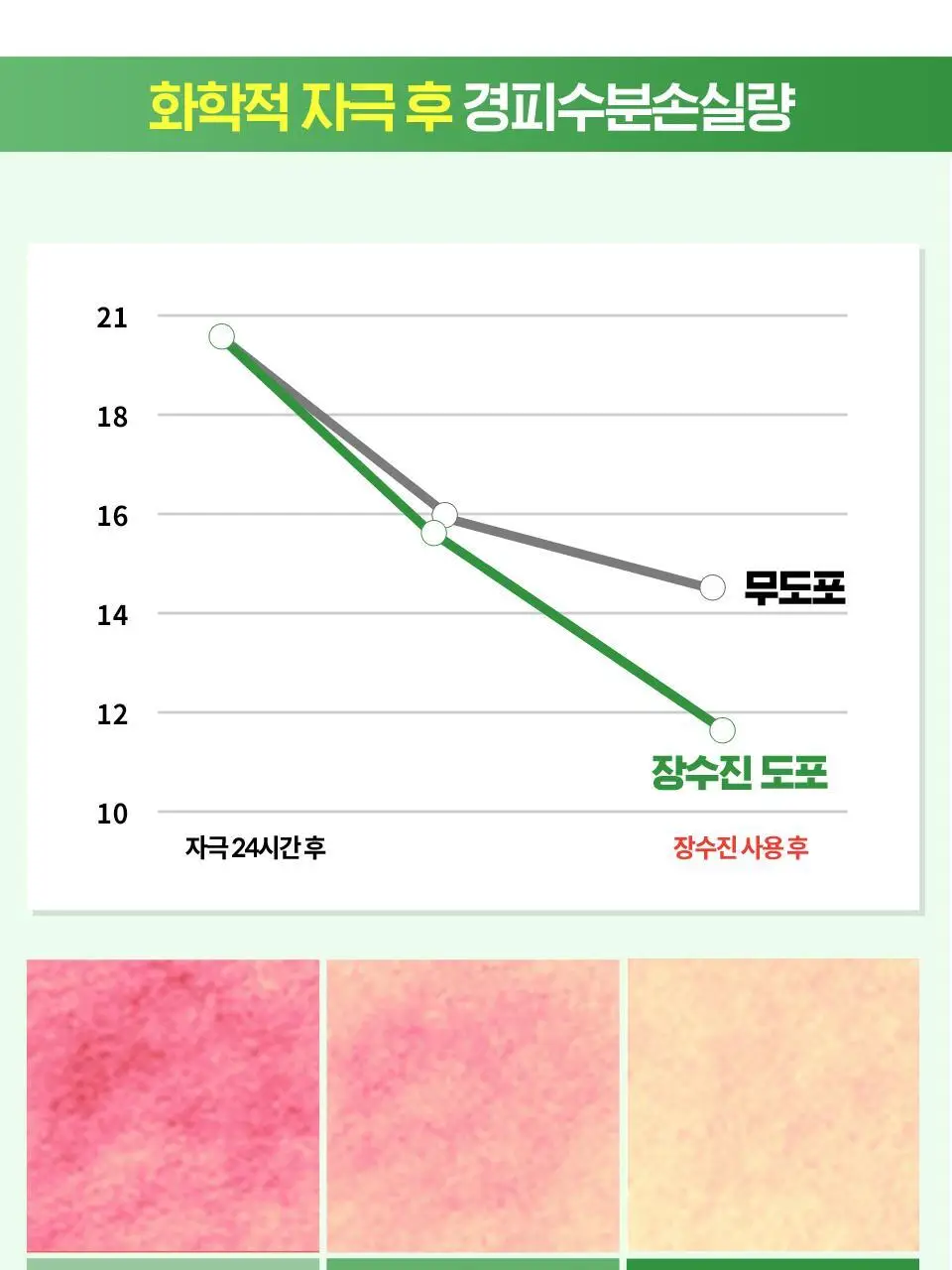 [수분엔젤광] 아이소이 모이스춰 닥터 장수진 수분크림 50ml 1+1 기획 (+20ml) 상세페이지 18